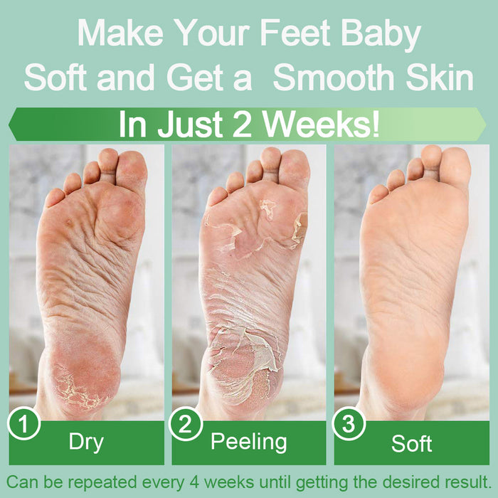 The Best Callus Remover for Baby-Smooth Feet